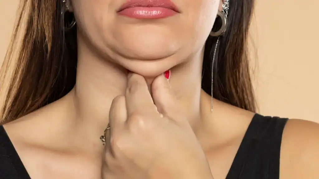 An image of a woman with double chin, sad, worried : Non Surgical Double Chin Removal Treatment in Bispham, UK