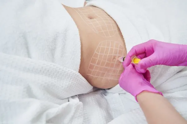 image of fat dissolving injections on love handles to help combat weight gain Bispham