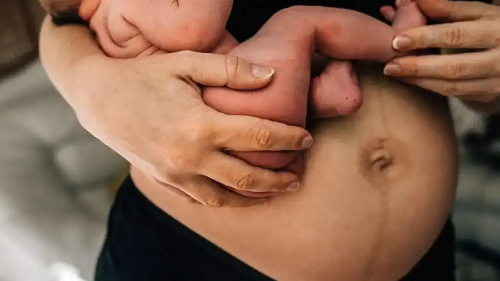 Why Is My Stomach Still Big After Pregnancy Bispham?